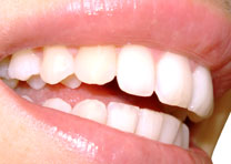 igiene orale dentifricio